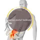 Un bacino ruotato può causare problemi neurologici. L'immagine mostra un modello anatomico con un bacino inclinato, evidenziato in rosso, e la scritta "Bacino storto? Inclinato?".