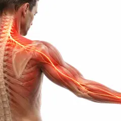 Illustrazione anatomica che mostra il **dolore muscolo collo spalla**, con nervi evidenziati in rosso e giallo lungo la colonna vertebrale, la spalla e il braccio.
