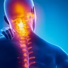 Dolore alla cervicale: un'illustrazione anatomica mostra la colonna vertebrale cervicale illuminata da un bagliore arancione, indicando infiammazione o dolore.