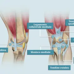 Anatomia del ginocchio: legamenti, menischi e tendini. Illustrazione che mostra le cause del laterale ginocchio dolore.