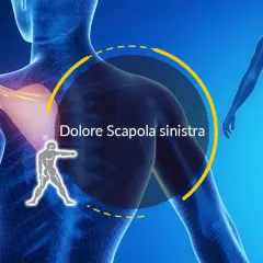 Dolore alla scapola sinistra, forse una contrattura. L'immagine mostra un modello anatomico con enfasi sulla spalla.