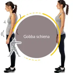 Postura scorretta con gobba schiena e postura corretta. Esercizi per migliorare la schiena.