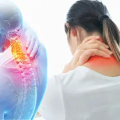 Dolore cervicale che si irradia a gambe e braccia. Anatomia del collo con vertebre evidenziate in giallo e aree di infiammazione in rosso.