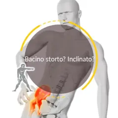 Un bacino ruotato può causare problemi neurologici. L'immagine mostra un modello anatomico con un bacino inclinato, evidenziato in rosso, e la scritta "Bacino storto? Inclinato?".