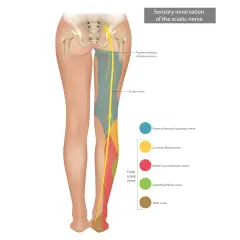 Illustrazione anatomica che mostra chi cura i nervi delle gambe, con il nervo sciatico e le sue ramificazioni.