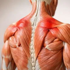 Dettaglio anatomico della schiena con muscoli evidenziati in rosso, indicando un possibile blocco alla schiena o infiammazione.