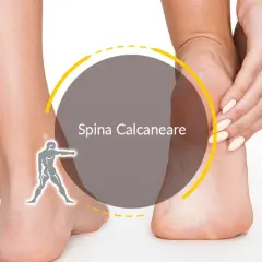 Dolore al tallone? La spina calcaneare può rendere difficile camminare, ma ci sono soluzioni.