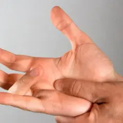 Mano con dito a scatto che si blocca.
