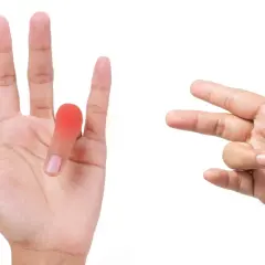 Mano con dito a scatto evidenziato in rosso, accanto a un'altra mano che esegue esercizi per il dito.