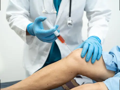 Recupero dopo PRP al ginocchio - tempi e attività da evitare