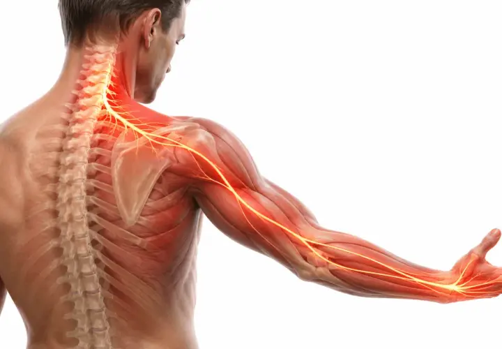 Illustrazione anatomica che mostra il **dolore muscolo collo spalla**, con nervi evidenziati in rosso e giallo lungo la colonna vertebrale, la spalla e il braccio.