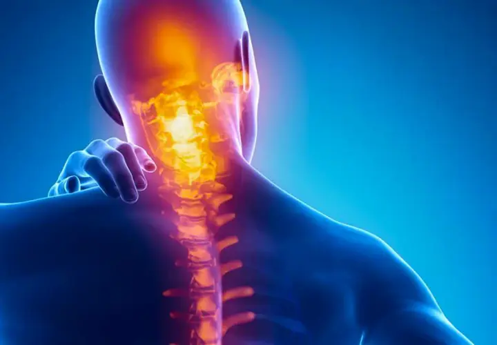 Dolore alla cervicale: un'illustrazione anatomica mostra la colonna vertebrale cervicale illuminata da un bagliore arancione, indicando infiammazione o dolore.