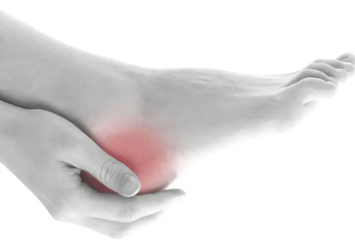 Mano che massaggia un tallone arrossato, indicando dolore ai talloni a letto.