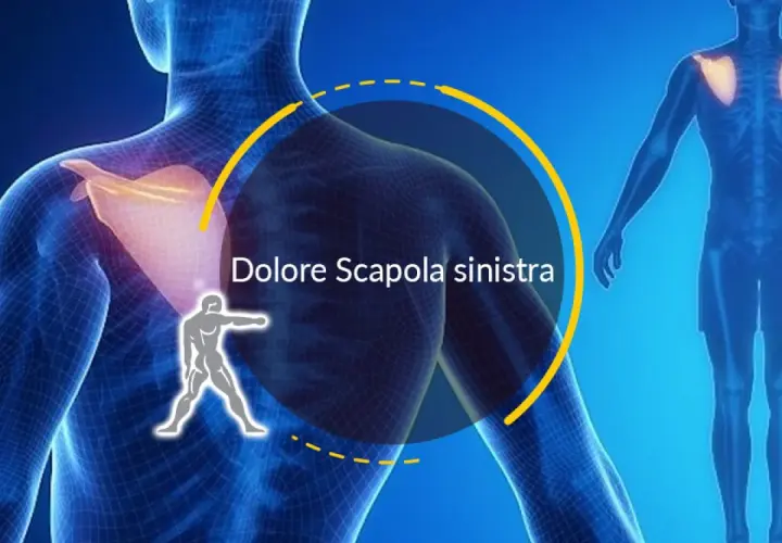 Dolore alla scapola sinistra, forse una contrattura. L'immagine mostra un modello anatomico con enfasi sulla spalla.
