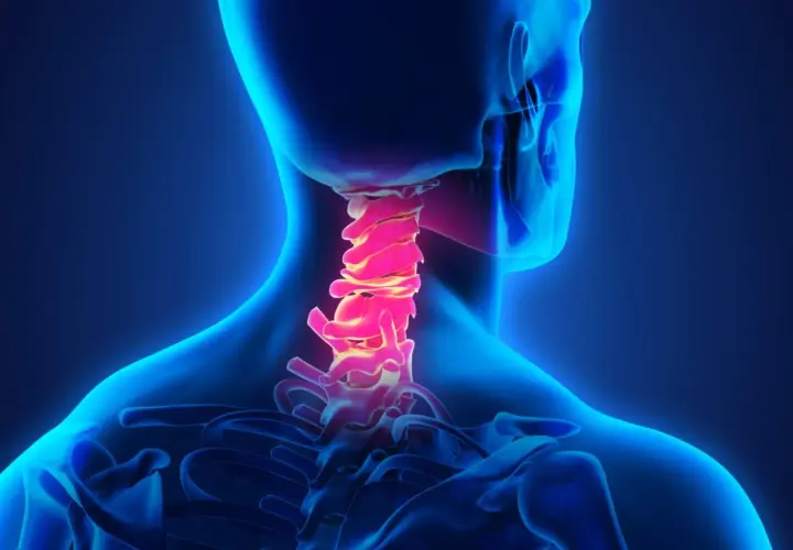 La colonna vertebrale cervicale, evidenziata in rosso, mostra la sua anatomia. Cos'è la cervicale? È la parte del collo che sostiene la testa.