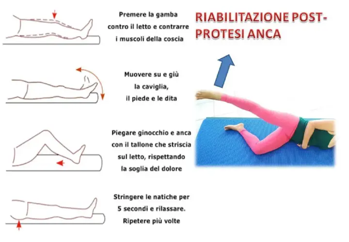 Esercizi per la riabilitazione post protesi anca: contrazione muscoli, mobilità caviglia, piegamenti ginocchio/anca e rinforzo glutei. Tempi di recupero variano.