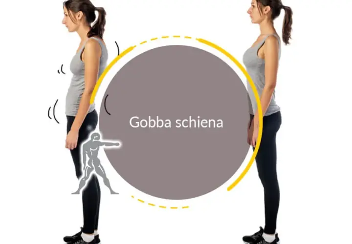 Postura scorretta con gobba schiena e postura corretta. Esercizi per migliorare la schiena.