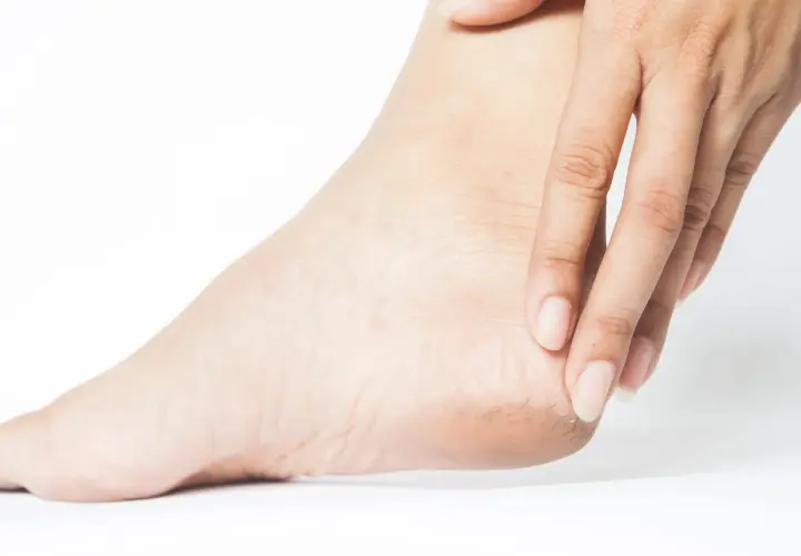 Dita sfiorano un tallone con pelle secca e screpolata, sintomo di spina calcaneare.