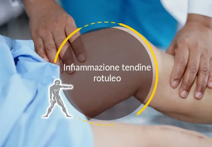 Esame del ginocchio con focus sull'infiammazione del tendine rotuleo. Un medico palpa la zona.