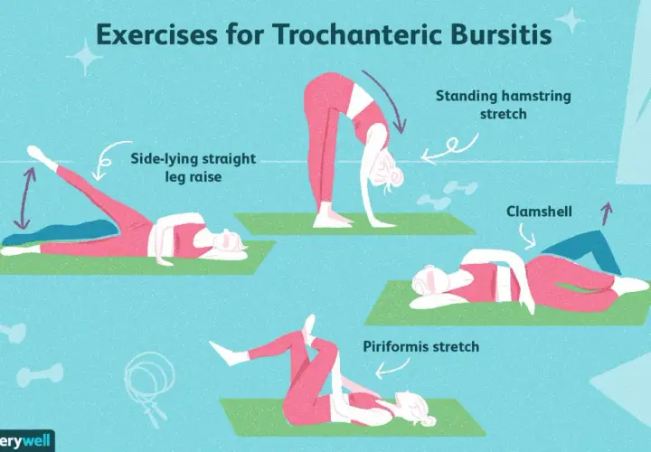 Esercizi per la trocanterite: sollevamento gamba laterale, stretching ischiocrurali, clamshell e piriforme. Rimedi efficaci.