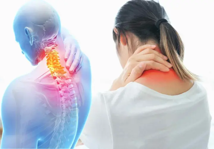 Dolore cervicale che si irradia a gambe e braccia. Anatomia del collo con vertebre evidenziate in giallo e aree di infiammazione in rosso.