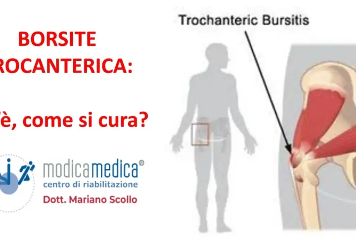 Borsite trocanterica che non passa? Immagine illustra la condizione e le opzioni di cura.