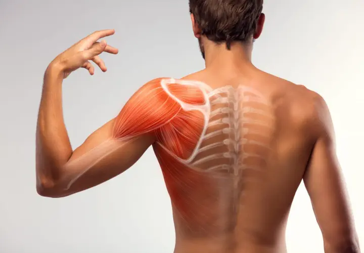 Muscolatura della spalla e schiena con evidenziate le fibre. Potrebbe indicare sintomi di tendine spalla sfilacciato.