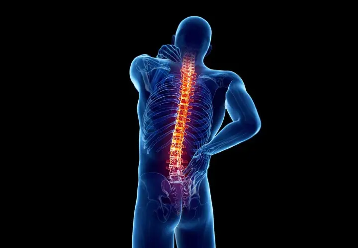 Schiena umana con colonna vertebrale evidenziata in rosso, suggerendo dolore o infiammazione, forse legata all'artrosi interapofisaria.