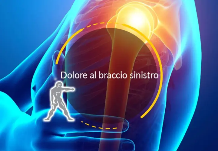 Dolore al braccio sinistro, possibile lesione tendine braccio cosa fare. Focus su spalla e omero.