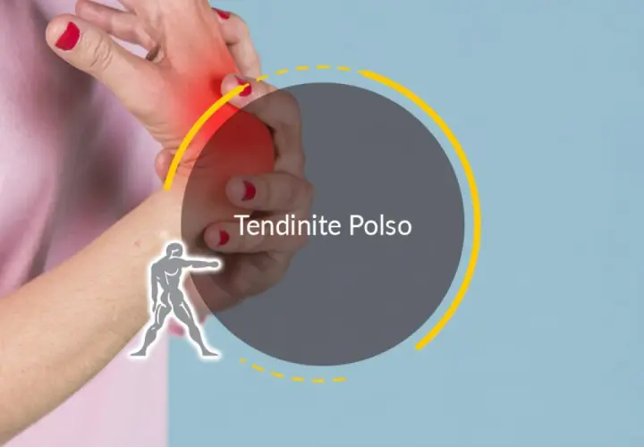 Mano con arrossamento e dolore al polso quando lo ruoto. Testo: Tendinite Polso.