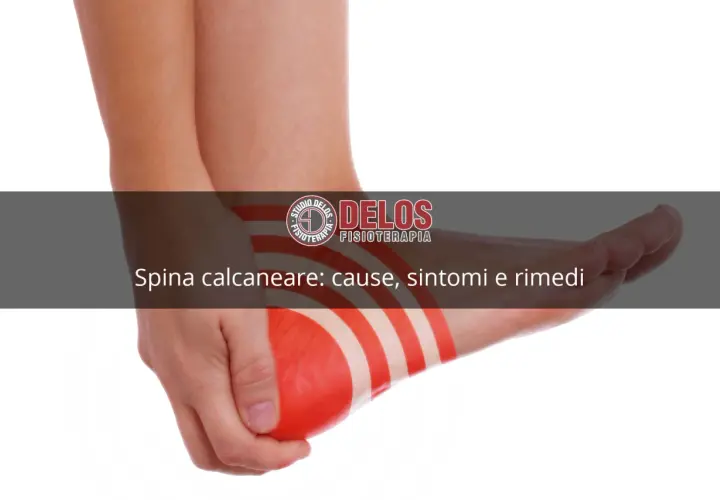 Dolore al tallone? L'immagine mostra una spina calcaneare con indicazioni sui rimedi.