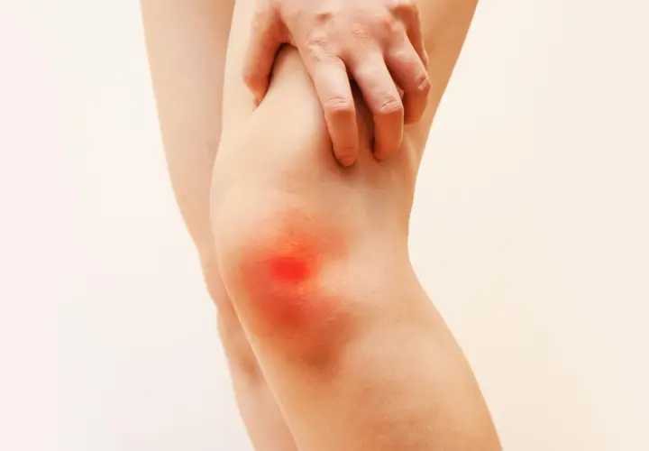 Gonalgia al ginocchio: una mano indica l'area infiammata, suggerendo la ricerca di una cura efficace per il dolore.