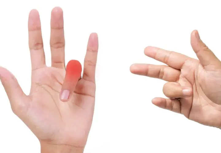 Mano con dito a scatto evidenziato in rosso, accanto a un'altra mano che esegue esercizi per il dito.