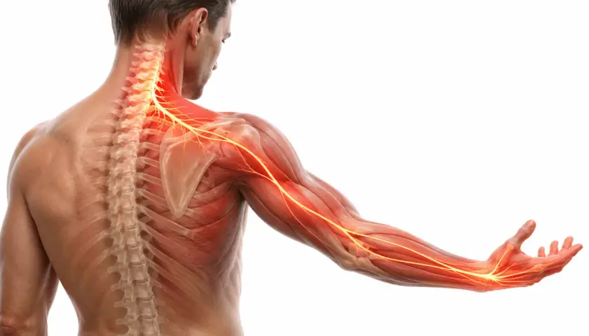 Illustrazione anatomica che mostra il **dolore muscolo collo spalla**, con nervi evidenziati in rosso e giallo lungo la colonna vertebrale, la spalla e il braccio.
