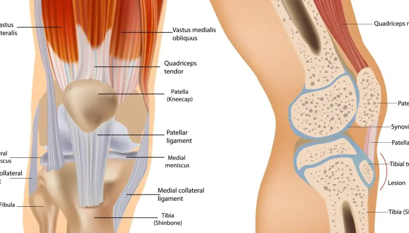 Illustrazione dell'anatomia del ginocchio, con muscoli, tendini, legamenti, menischi e ossa evidenziati.