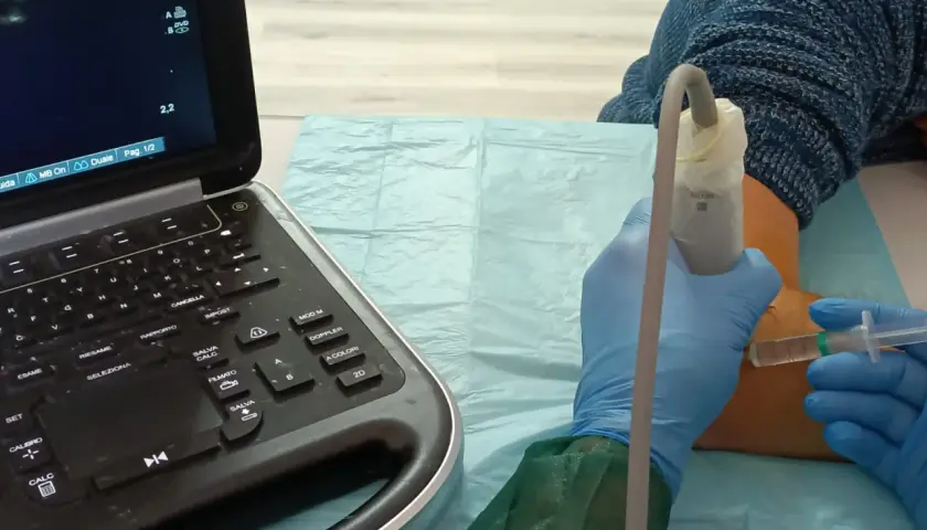 Ecografia guidata per infiltrazioni al gomito. Un medico con guanti blu esegue un'iniezione sotto guida ecografica.