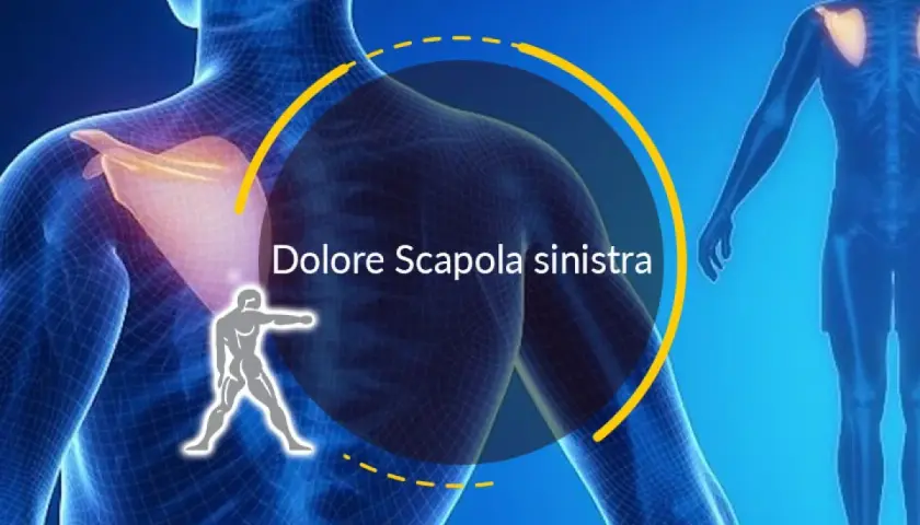Dolore alla scapola sinistra, forse una contrattura. L'immagine mostra un modello anatomico con enfasi sulla spalla.