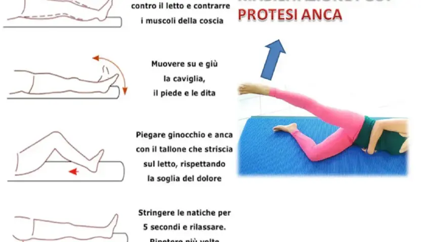Esercizi per la riabilitazione post protesi anca: contrazione muscoli, mobilità caviglia, piegamenti ginocchio/anca e rinforzo glutei. Tempi di recupero variano.