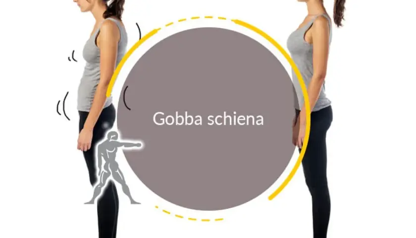 Postura scorretta con gobba schiena e postura corretta. Esercizi per migliorare la schiena.