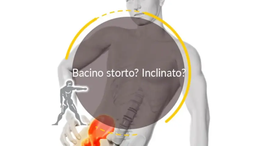 Un bacino ruotato può causare problemi neurologici. L'immagine mostra un modello anatomico con un bacino inclinato, evidenziato in rosso, e la scritta "Bacino storto? Inclinato?".