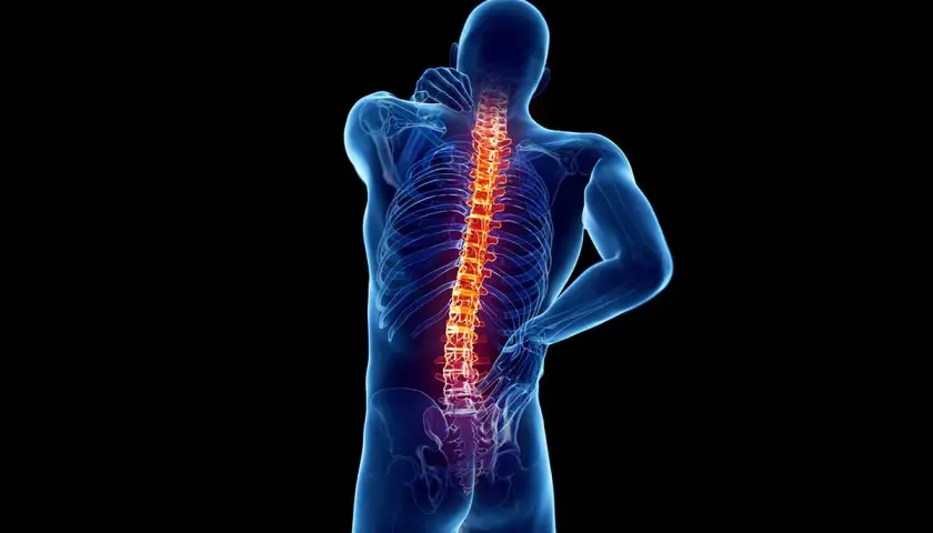 Schiena umana con colonna vertebrale evidenziata in rosso, suggerendo dolore o infiammazione, forse legata all'artrosi interapofisaria.