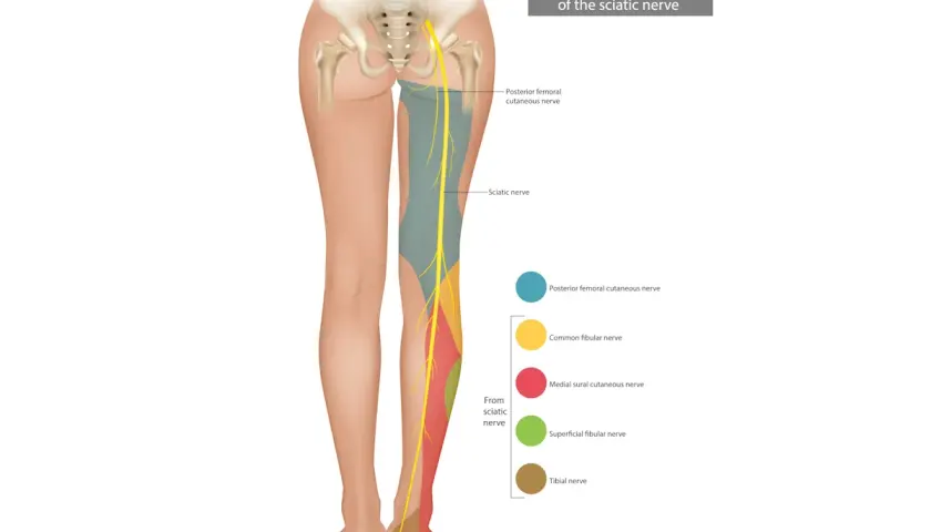 Illustrazione anatomica che mostra chi cura i nervi delle gambe, con il nervo sciatico e le sue ramificazioni.