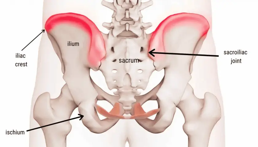 Anatomia del bacino con evidenziato il dolore alla cresta iliaca, sintomi comuni di infiammazione.