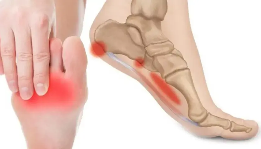 Dolore sotto tallone evidenziato in rosso su un piede e un'illustrazione anatomica.