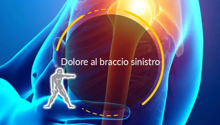 Dolore al braccio sinistro, possibile lesione tendine braccio cosa fare. Focus su spalla e omero.