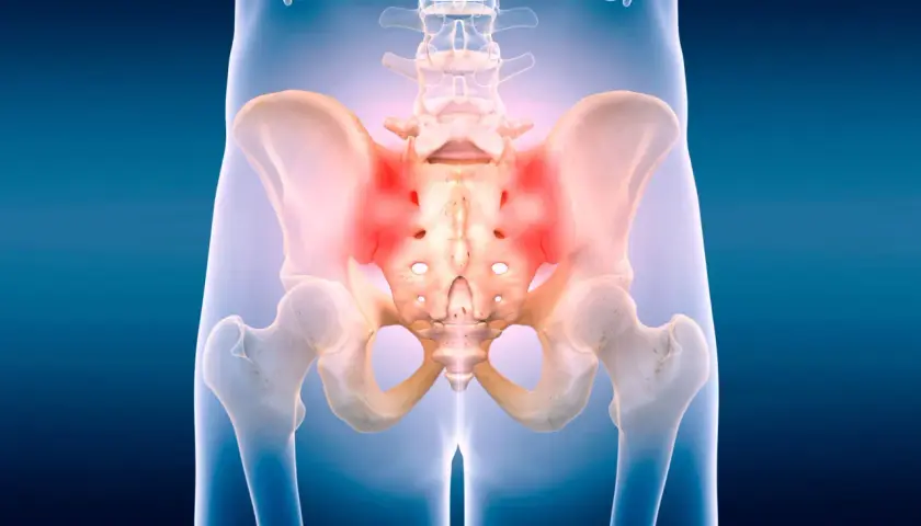 Dolore al cingolo pelvico evidenziato in rosso. L'immagine mostra l'anatomia del bacino e della colonna vertebrale inferiore con aree di infiammazione.