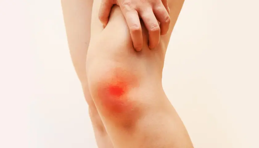 Gonalgia al ginocchio: una mano indica l'area infiammata, suggerendo la ricerca di una cura efficace per il dolore.