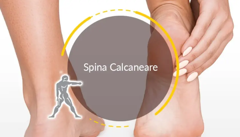 Dolore al tallone? La spina calcaneare può rendere difficile camminare, ma ci sono soluzioni.