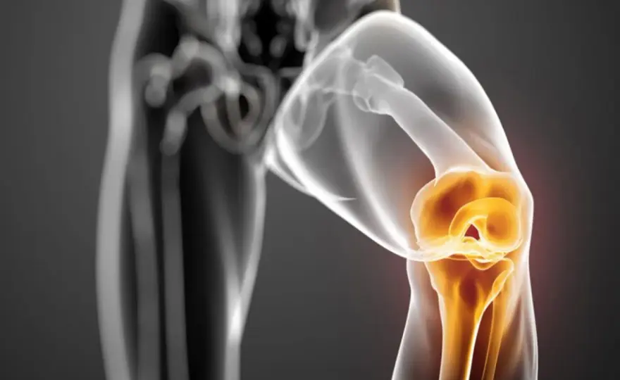 Menisco lesionato, si può camminare? Cosa fare e quando