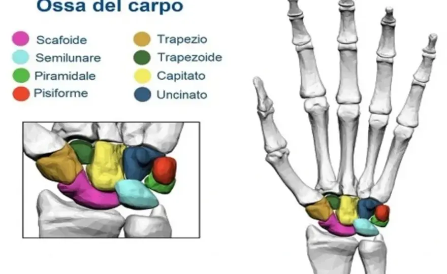 Artrite del polso - sintomi, cause e cure da conoscere